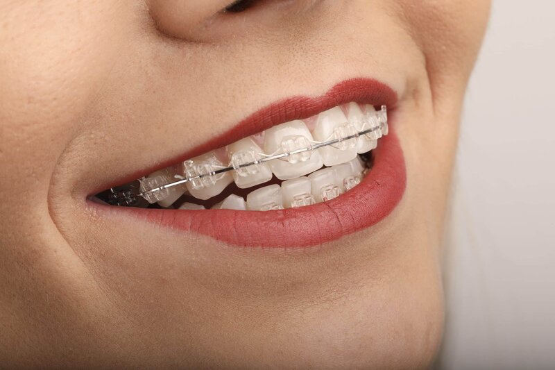 Denttaglio Clinic - Clinica stomatologica ultramoderna